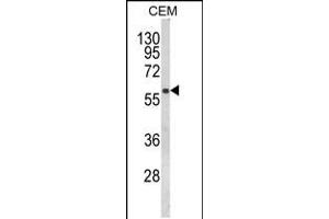 Western blot analysis of FLCN Antibody in CEM cell line lysates (35ug/lane)