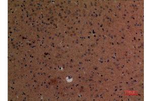 Immunohistochemistry (IHC) analysis of paraffin-embedded Mouse Brain, antibody was diluted at 1:100.
