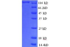 SDS-PAGE (SDS) image for phosphorylase, Glycogen, Liver (PYGL) (AA 2-846), (partial) protein (GST tag) (ABIN5710195)