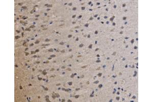IHC analysis of MRPS25 using anti-MRPS25 antibody (ABIN7599032).