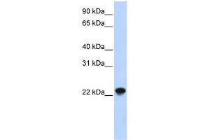 WB Suggested Anti-ARL8A Antibody Titration: 0.