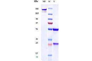 Anti-VEGFC Reference Antibody (VGX100) on SDS-PAGE under reducing (R) condition. (Recombinant VEGFC anticorps)