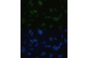 Immunofluorescence analysis of U-2OS cells using DNA-PKcs antibody (ABIN6134326, ABIN6146218, ABIN6146219 and ABIN6223647) at dilution of 1:100.