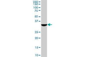 MEOX2 monoclonal antibody (M08), clone 5E1. (MEOX2 anticorps  (AA 1-303))