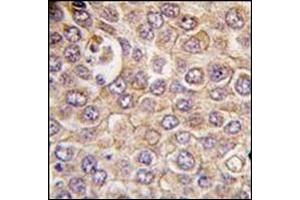 Immunohistochemistry (IHC) image for anti-Microtubule-Associated Protein 1 Light Chain 3 alpha (MAP1LC3A) antibody (ABIN5551132)