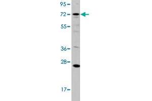 Western blot analysis of HL-60 cell lysate (35 ug/lane) with DGKA polyclonal antibody . (DGKA anticorps  (C-Term))