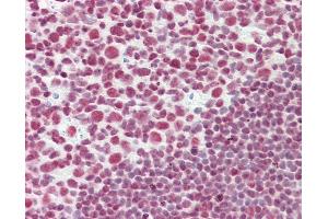 Anti-CELF2 / CUGBP2 antibody IHC staining of human tonsil. (CELF2 anticorps  (AA 481-508))