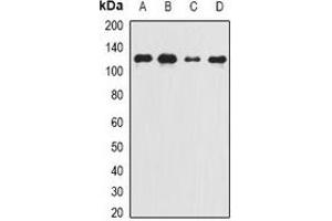 Western blot analysis of Complement C5 expression in Raji (A), Jurkat (B), mouse heart (C), rat liver (D) whole cell lysates. (C5 anticorps)