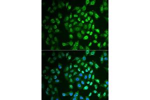 Immunofluorescence analysis of A549 cells using FAH antibody.
