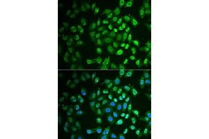 Immunofluorescence analysis of A549 cells using FAH antibody. (FAH anticorps  (AA 1-419))