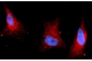Immunofluorescence (IF) image for anti-Pyruvate Dehydrogenase Kinase 1 (PDK1) (AA 29-436), (Isoform 1) antibody (APC) (ABIN5565278) (PDK1 anticorps  (Isoform 1) (APC))