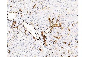 Immunohistochemistry analysis of paraffin-embedded human liver using AQP1 Polyclonal Antibody at dilution of 1:400. (Aquaporin 1 anticorps)