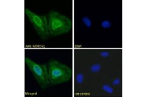 ABIN6391411 Immunofluorescence analysis of paraformaldehyde fixed U2OS cells, permeabilized with 0. (Notch1 anticorps  (AA 171-182))