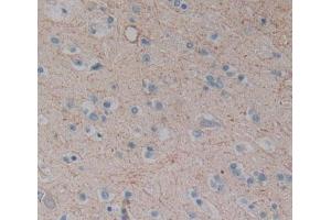 Used in DAB staining on fromalin fixed paraffin- embedded Kidney tissue (CPEB1 anticorps  (AA 311-561))