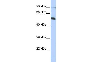 WB Suggested Anti-ZNF641 Antibody Titration:  0. (ZNF641 anticorps  (Middle Region))