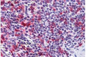 Human Spleen: Formalin-Fixed, Paraffin-Embedded (FFPE) (PCDH12 anticorps  (N-Term))