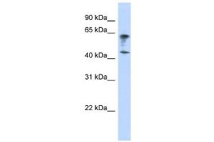 IGSF11 antibody used at 1 ug/ml to detect target protein. (IGSF11 anticorps  (Middle Region))