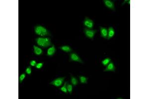 Immunofluorescence analysis of A549 cells using GTF2F2 antibody.