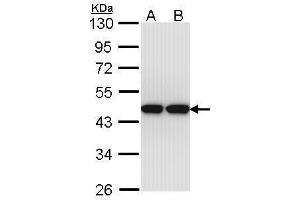 WB Image Sample (30 ug of whole cell lysate) A: Hep G2 , B: Molt-4 , 10% SDS PAGE antibody diluted at 1:1000 (Actin-Like 8 anticorps)