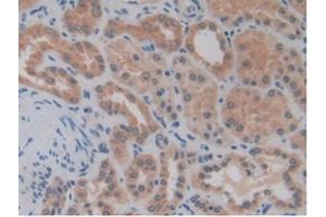 IHC-P analysis of Human Kidney Tissue, with DAB staining. (MMP14 anticorps  (AA 112-321))