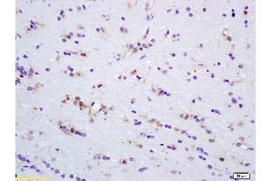 Formalin-fixed and paraffin embedded rat brain tissue labeled Anti-MAPK4 Polyclonal Antibody, Unconjugated  at 1:200, followed by conjugation to the secondary antibody and DAB staining