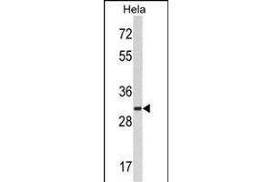 Western blot analysis of hRCKS- (ABIN389097 and ABIN2839288) in Hela cell line lysates (35 μg/lane). (MARCKS anticorps  (C-Term))