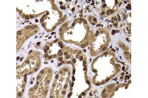 Immunohistochemistry of paraffin-embedded Human kidney using GPS1 Polyclonal Antibody at dilution of 1:100 (40x lens).