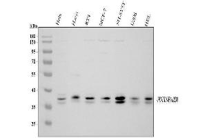 Western blot analysis of hnRNP A2B1 using anti-hnRNP A2B1 antibody (ABIN5692872).