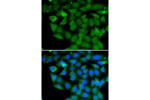 Immunofluorescence analysis of A549 cell using ELAC2 antibody. (ELAC2 anticorps)