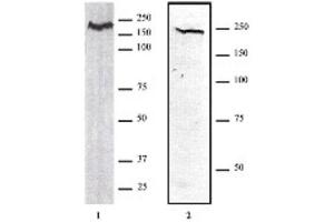 CHD1 antibody (pAb) tested by Western blot. (CHD1 anticorps  (AA 251-467))