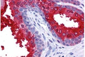 Human Prostate: Formalin-Fixed, Paraffin-Embedded (FFPE) (SCUBE2 anticorps  (Internal Region))