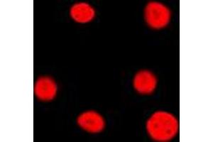 Immunofluorescent analysis of Estrogen Receptor 2 staining in HeLa cells. (ESR2 anticorps  (Center))