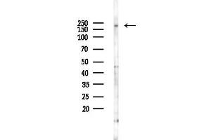 anti-Fibronectin 1 (FN1) (C-Term) antibody