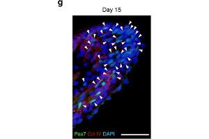 Immunohistochemistry (IHC) image for anti-Collagen, Type IV (COL4) antibody (ABIN5596835)