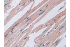 Detection of AGRP in Mouse Heart Tissue using Polyclonal Antibody to Agouti Related Protein (AGRP)