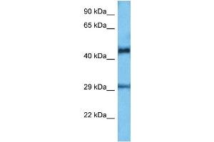 Host:  Mouse  Target Name:  ETV6  Sample Tissue:  Mouse Small Intestine  Antibody Dilution:  1ug/ml
