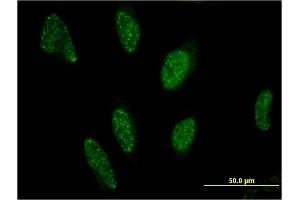 Immunofluorescence of monoclonal antibody to PPARA on HeLa cell. (PPARA anticorps  (AA 1-258))