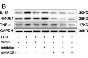 The effects of miR-339-5p and HMGB1-siRNA on LPS-induced RAW264.