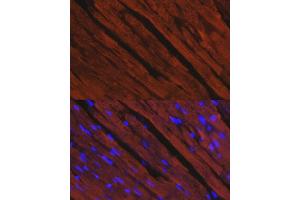 Immunofluorescence analysis of rat heart using MYH6/α-MHC antibody (ABIN6129610, ABIN6144236, ABIN6144237 and ABIN6216792) at dilution of 1:100. (MYH6 anticorps  (AA 1-250))