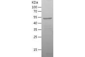 Western Blotting (WB) image for Solute Carrier Family 20 (Phosphate Transporter), Member 1 (SLC20A1) (AA 253-510) protein (His-IF2DI Tag) (ABIN7125157)