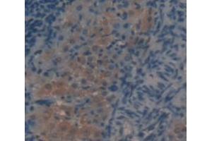 IHC-P analysis of Rat Tissue, with DAB staining. (LALBA anticorps  (AA 20-159))