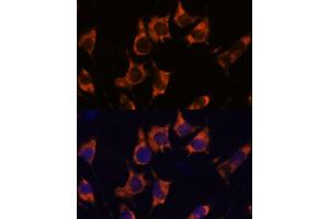 Immunofluorescence analysis of L929 cells using NDRG4 antibody  at dilution of 1:100. (NDRG4 anticorps  (AA 140-220))