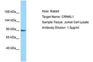 Image no. 1 for anti-Crooked Neck Pre-mRNA Splicing Factor-Like 1 (CRNKL1) (AA 760-809) antibody (ABIN6750173)
