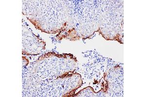 Anti-Annexin A1 antibody, IHC(P) IHC(P): Human Tonsil Tissue