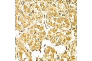 Immunohistochemistry of paraffin-embedded human gastric using SESN2 antibody at dilution of 1:100 (x400 lens).