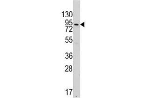Western blot analysis of VE Cadherin antibody and 293 lysate.