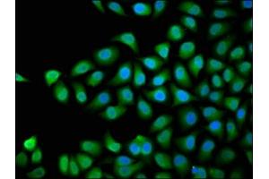 Immunofluorescence staining of Hela cells with ABIN7168754 at 1:66, counter-stained with DAPI.