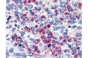 Immunohistochemistry staining of human spleen (paraffin sections) using anti-CD63 (TEM-259).