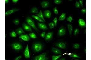 Immunofluorescence of monoclonal antibody to KRTHB1 on HeLa cell. (KRT81 anticorps  (AA 1-202))