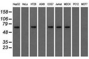 Image no. 6 for anti-Insulin-Like Growth Factor 2 mRNA Binding Protein 2 (IGF2BP2) antibody (ABIN1498822) (IGF2BP2 anticorps)